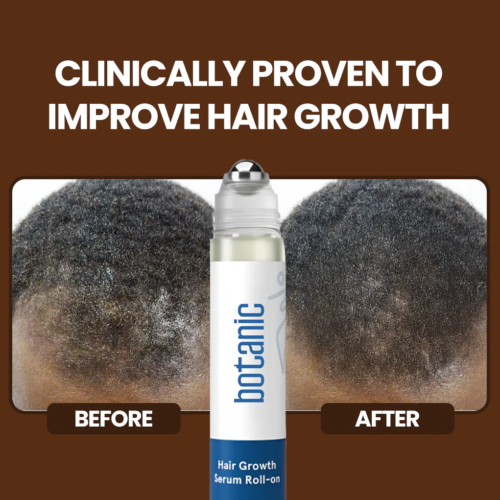 Patented Rosemary Hair Growth Roll-On Serum - Image 4